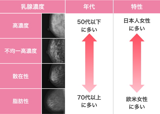 乳腺濃度の説明