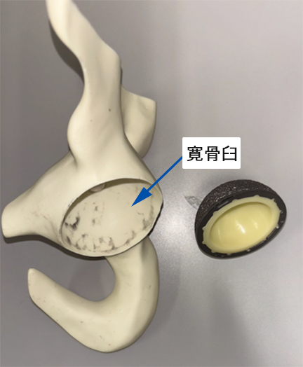 左骨盤の模型