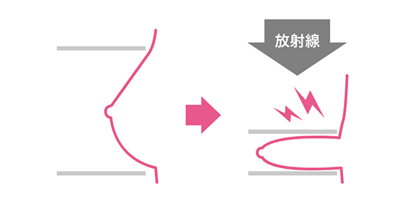 圧迫版でやや強めに乳房をおさえ、平らにのばします。